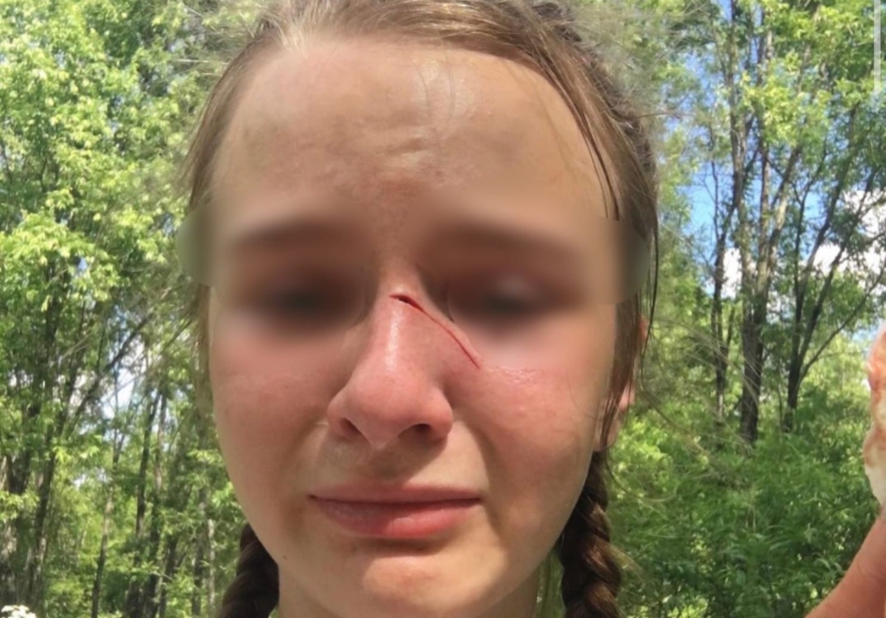 В Кузбассе сотрудник МЧС кинул банку тушёнки в лицо девочке