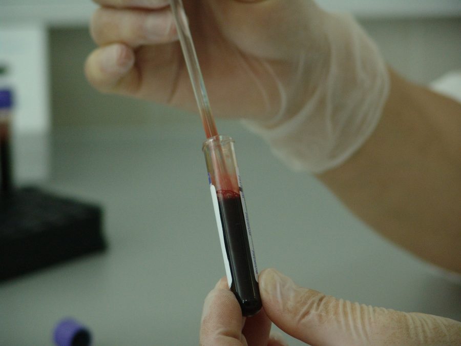 В Кемерове начали забирать плазму у переболевших коронавирусом